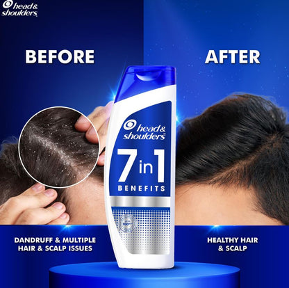 Head & Shoulders 7 In 1 Anti-Dandruff Shampoo, 180 ml